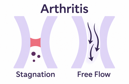 Sore Muscles, Stiff Joints, and Arthritis: Relief